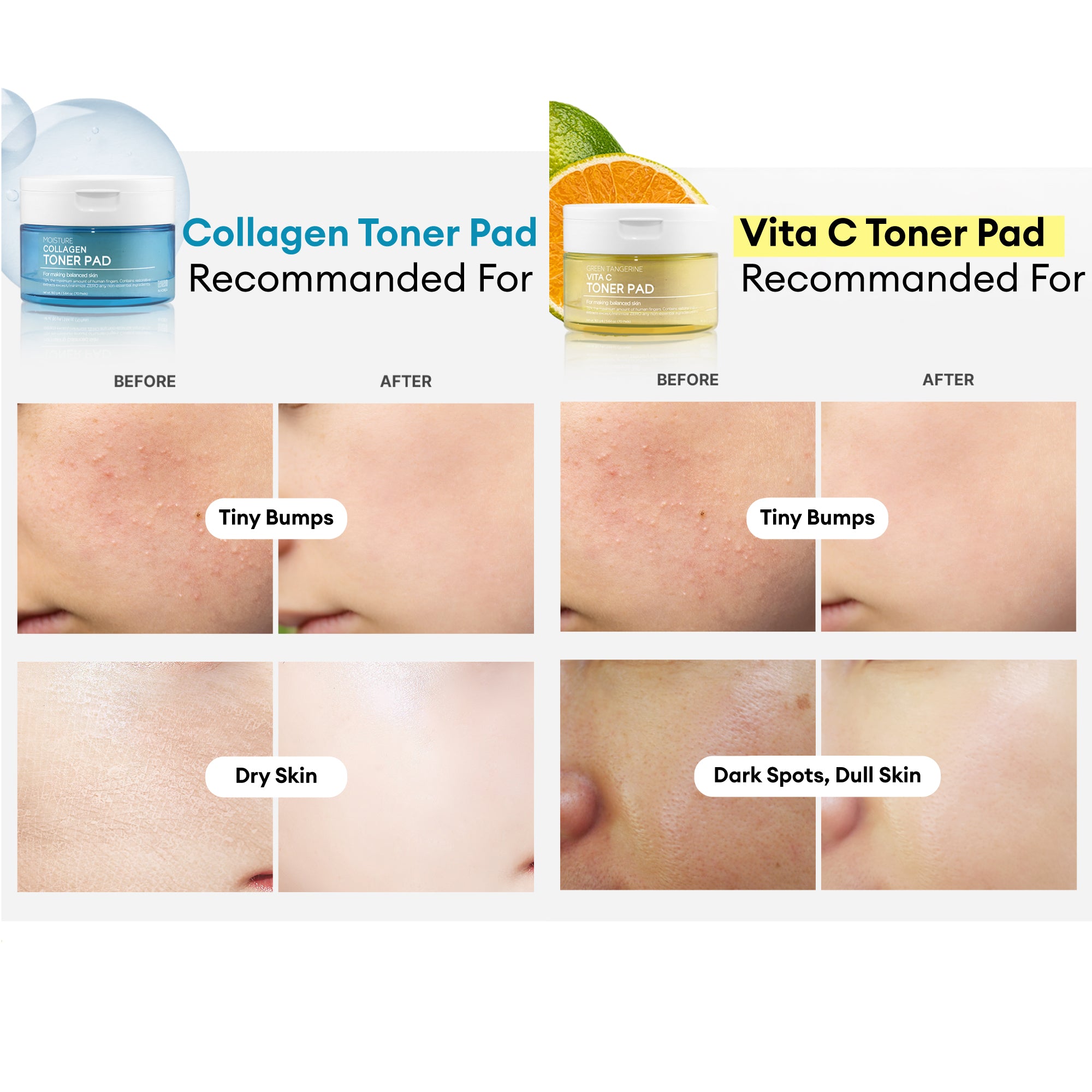 TENZERO MOISTURE COLLAGEN TONER PAD