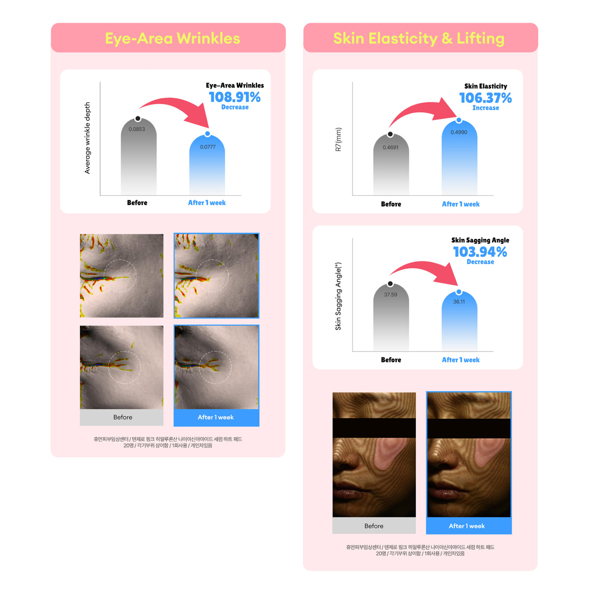 TENZERO PINK HYALURONIC ACID NIACINAMIDE SERUM HEART PAD